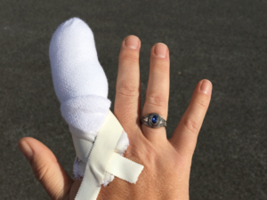 A picture of Anne Gibson's hand with the index finger wrapped so heavily in gauze it looks like a cartoon character